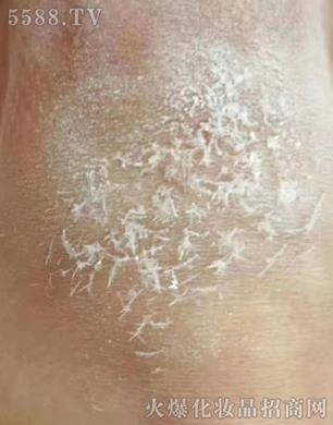 �����̌WԺ�����Ρ���(y��u)��