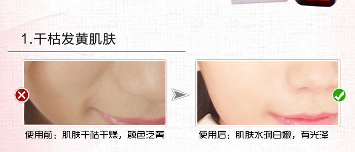 ¡�������ݝ����ޏ�(f��)˪�׺�