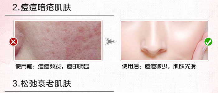 ¡�������ݝ����ޏ�(f��)˪�׺�